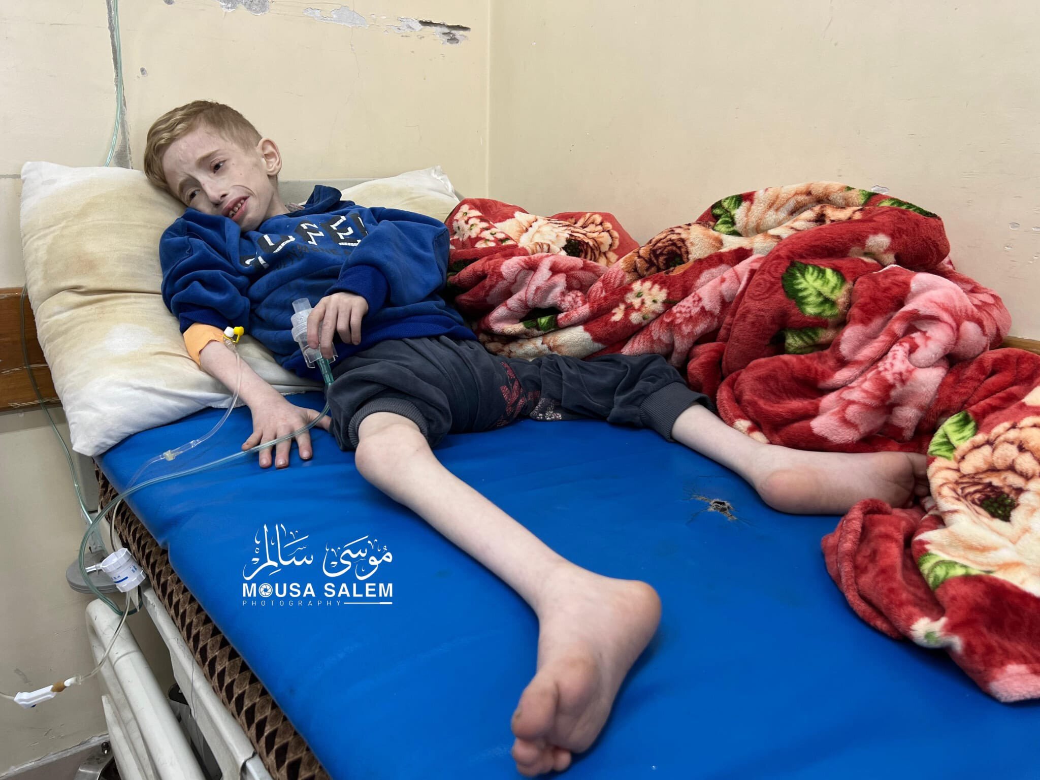 افزایش شمار شهدای سوءتغذیه و گرسنگی در نوار غزه؛ ۲۵ نفر به شهادت رسیدند افزایش شمار شهدای سوءتغذیه و گرسنگی در نوار غزه؛ ۲۵ نفر به شهادت رسیدند