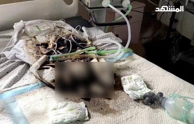 درخواست تحقیق بینالمللی درباره رها کردن ۵ نوزاد نارس در بیمارستان النصر غزه از سوی ارتش رژیم صهیونیستی درخواست تحقیق بینالمللی درباره رها کردن ۵ نوزاد نارس در بیمارستان النصر غزه از سوی ارتش رژیم صهیونیستی