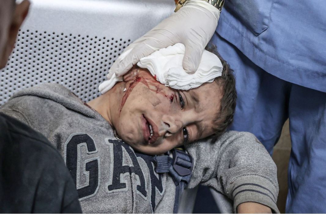 کودکان غزه قربانی اصلی تجاوزات رژیم صهیونیستی کودکان غزه قربانی اصلی تجاوزات رژیم صهیونیستی