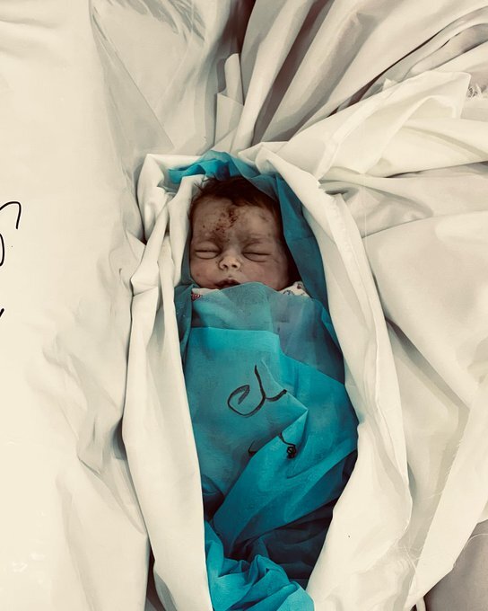 ناظر حقوق بشر اروپا: رژیم صهیونیستی عمدا زیرساختهای غیرنظامی را هدف قرار میدهد/ ۲۵ هزار شهید در ۷۰ روز ناظر حقوق بشر اروپا: رژیم صهیونیستی عمدا زیرساختهای غیرنظامی را هدف قرار میدهد/ ۲۵ هزار شهید در ۷۰ روز